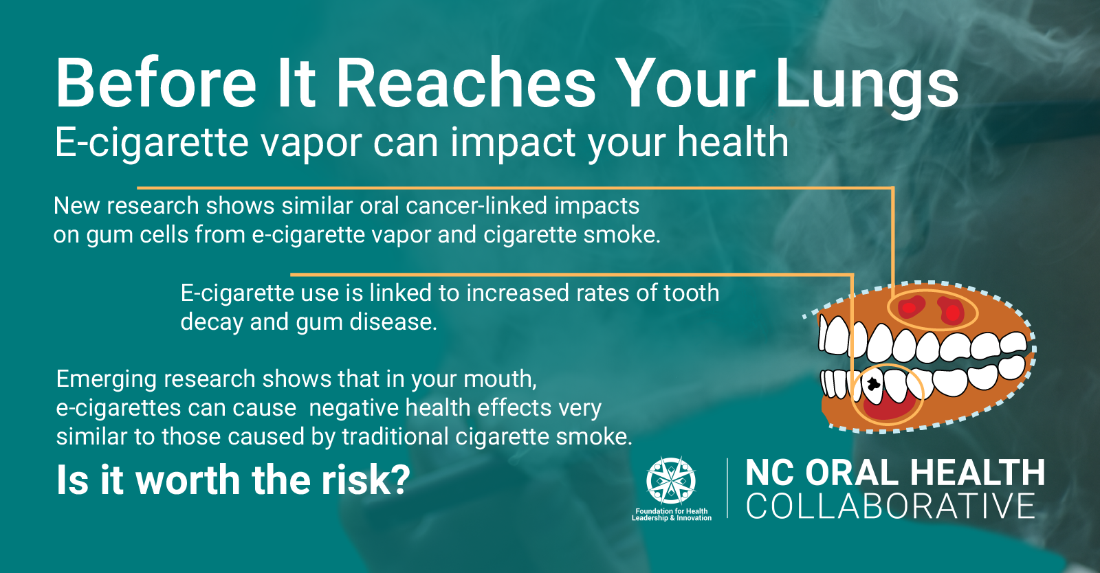 Graphic depicting the potential risks of e-cigarettes, including gum disease, tooth decay, and oral cancer