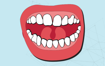 How to Keep Your Gums Healthy, and Why It Matters
